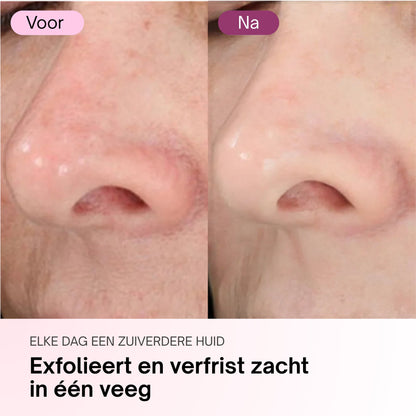 Zero Pore Pads